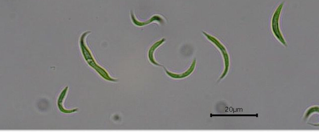 Microalgas Monoraphidium contortum bajo microscopio óptico utilizadas para eliminar antibióticos en aguas residuales.