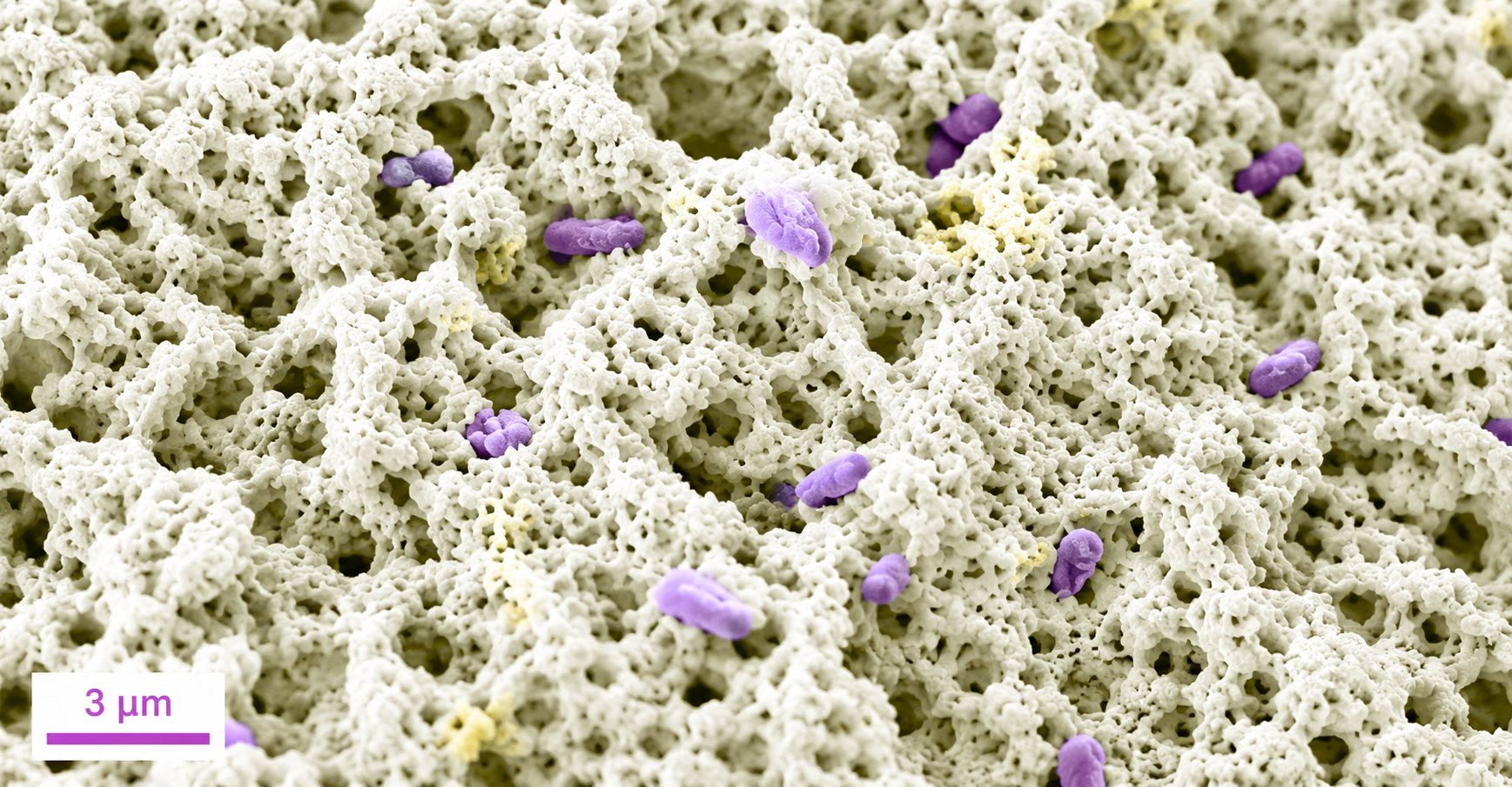 Micrografía de un biorecubrimiento bacteriano poroso con bacterias inmovilizadas para tratamiento de aguas residuales.